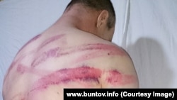 Виталий Бунтов, в очередной раз подвергнутый пыткам сотрудниками администрации колонии ИК-12 Пермского края