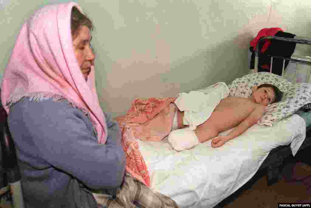 Дети - самые беззащитные жертвые войны. Восьмилетний мальчик потерял ногу во время бомбежки. Госпиталь в Урус-Мартане в 25 км к западу от Грозного. 18 января 1995 года.